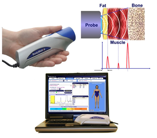 Equipamento BodyMetrix e visualização de gordura, músculo e osso